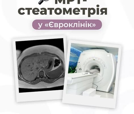 МРТ-стеатометрія — новітня технологія для оцінки стану печінки та кількості жиру в ній без болю та дискомфорту ✅